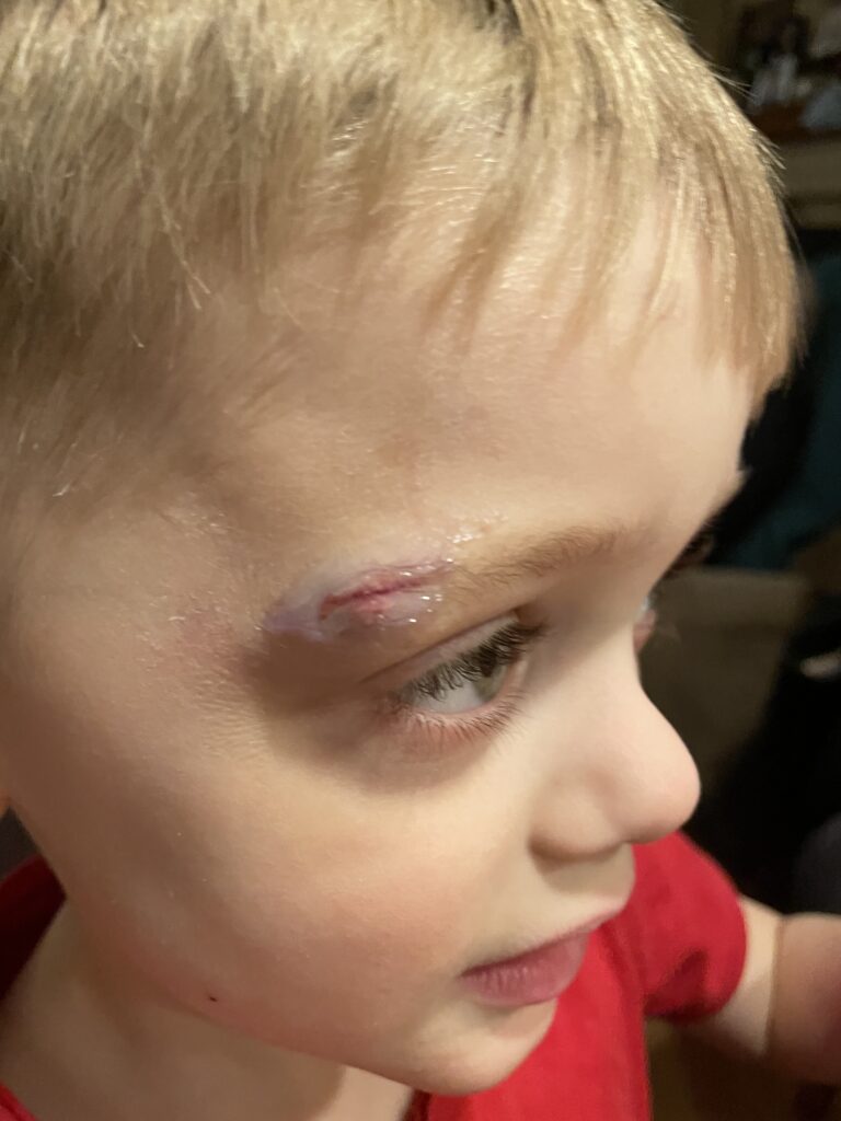 No holidays would be complete without a trip to the ER.